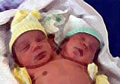 В Бразилии родился двухголовый малыш
(видео)