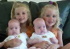 В Америке близнецы стали рождаться почти в два раза чаще
